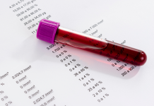 5 consejos para cuidar tu sangre y tu salud