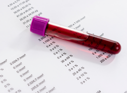 5 consejos para cuidar tu sangre y tu salud 1