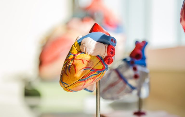 ¿Qué es una arritmia cardiaca y cuáles son sus causas?