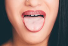 ¿Por qué la lengua se pone blanca?