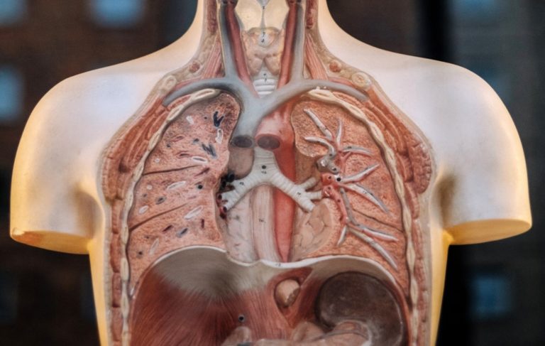 ¿Qué es una embolia pulmonar?