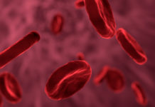 Qué es la anemia ferropénica