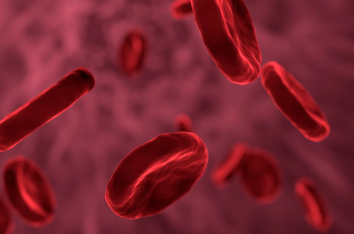 Causas y tratamientos de la anemia ferropénica