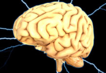 ¿Qué significa tener parálisis cerebral?