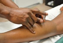 ¿Qué son los  puntos de  acupuntura?