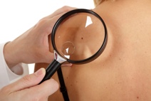 Aumentan un 38% los casos de cáncer de piel en España. Aumentan un 38% los casos de cáncer de piel en España.